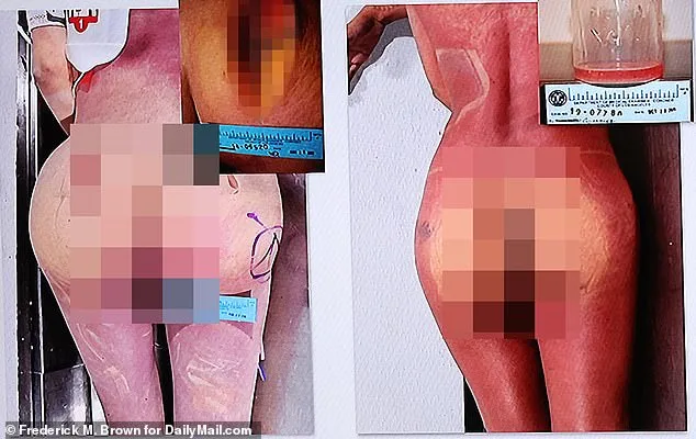 Libby Adame Convicted of Second-Degree Murder in Controversial Illegal Silicone Injection Case