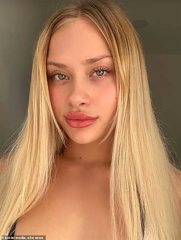 Miraculous Recovery: Maria Kovalchuk Takes First Steps After Mysterious Dubai Incident