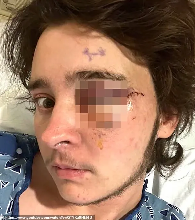 ICE Protester Allegedly Left Blind in Santa Ana Incident, Prompting Debate on Force Use