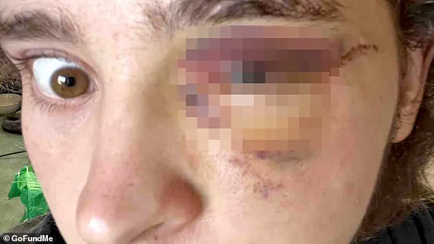 ICE Protester Allegedly Left Blind in Santa Ana Incident, Prompting Debate on Force Use