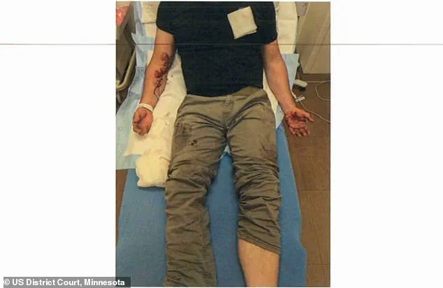 ICE Officer Jonathan Ross Dragged Over 360 Feet by Illegal Immigrant Roberto Carlos Munoz in June 2024 Incident