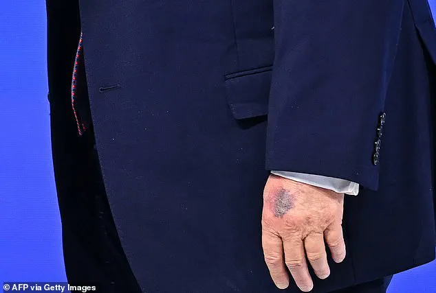 President Trump's Return from Davos Brings Media Scrutiny Over Hand Bruise and Demanding Schedule