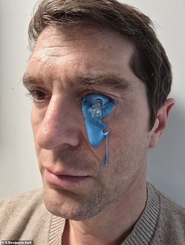 Journalist Benjamin Hall's Recovery: Mold Removal and Ongoing Healing After Ukraine Blast