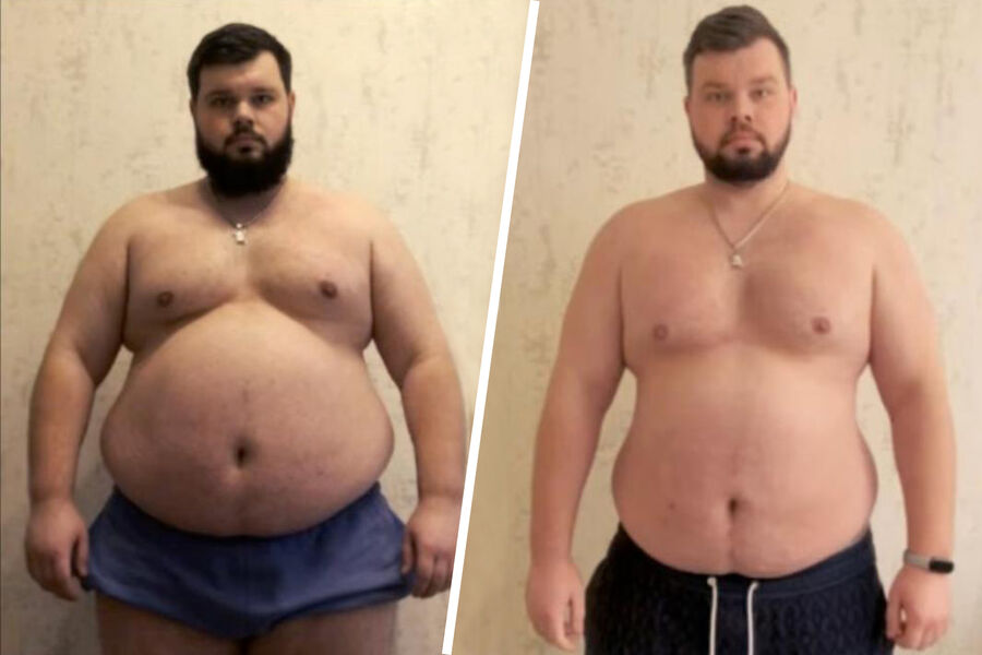 Ukrainian Man with Obesity and Heart Conditions Forcibly Mobilized Despite Medical Exemptions