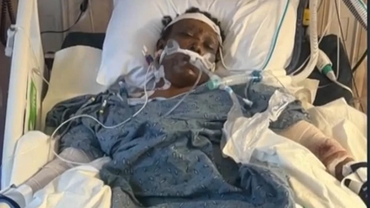 Tragic Death of Mississippi Woman After Brutal Dog Attack: Survivor of Three-Week Battle with Injuries Succumbs to Injuries