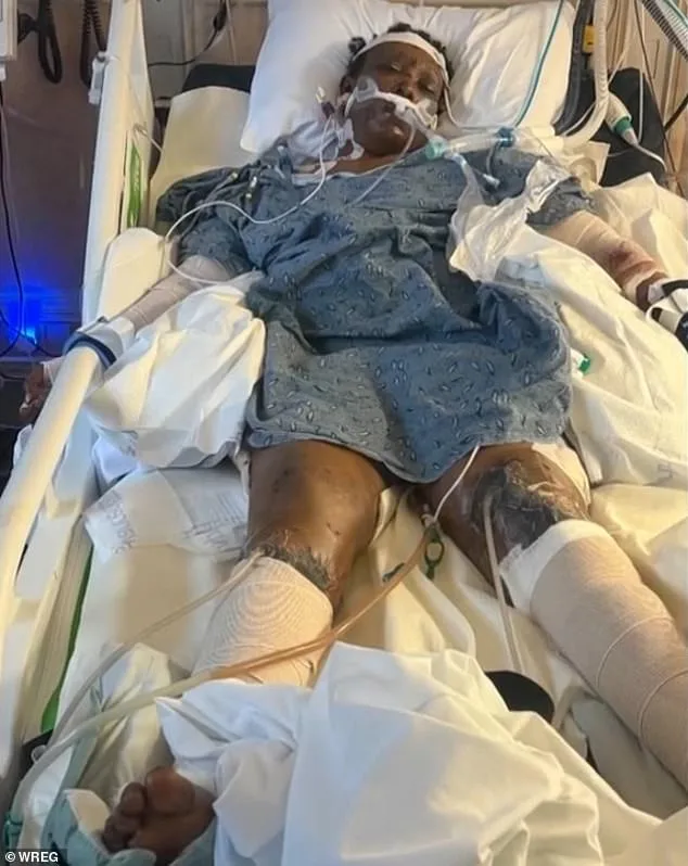 Tragic Death of Mississippi Woman After Brutal Dog Attack: Survivor of Three-Week Battle with Injuries Succumbs to Injuries