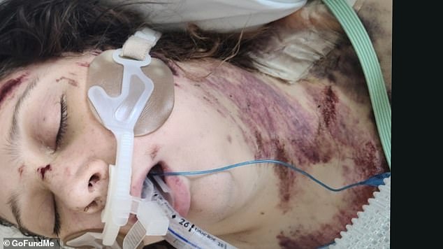 Disabled Woman Run Over Multiple Times by Drunk Driver in Lafayette