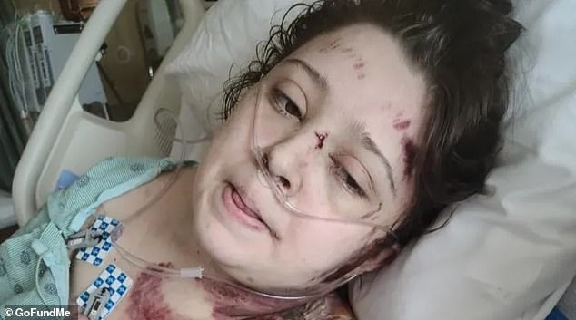 Disabled Woman Run Over Multiple Times by Drunk Driver in Lafayette