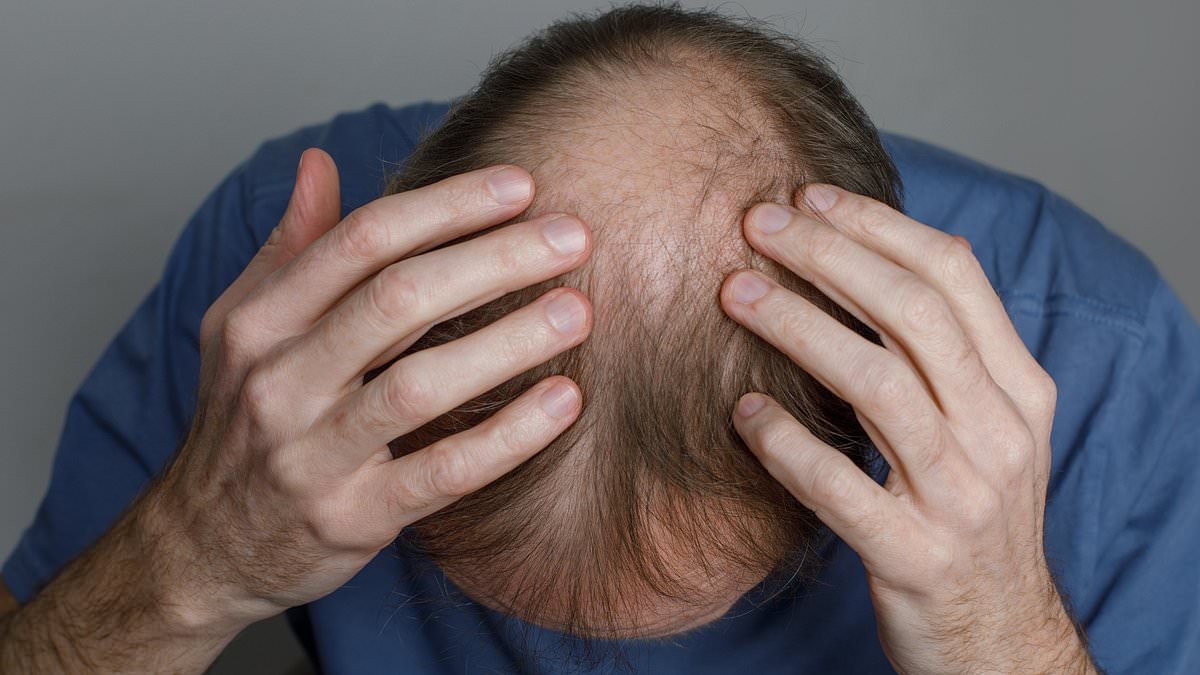 Veradermics' new oral Minoxidil quadruples hair regrowth in pivotal study.