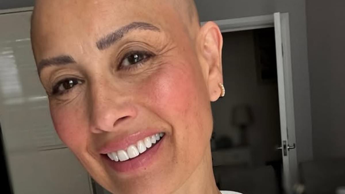 Medical experts warn that early alopecia signs include excess shedding and patchy loss.