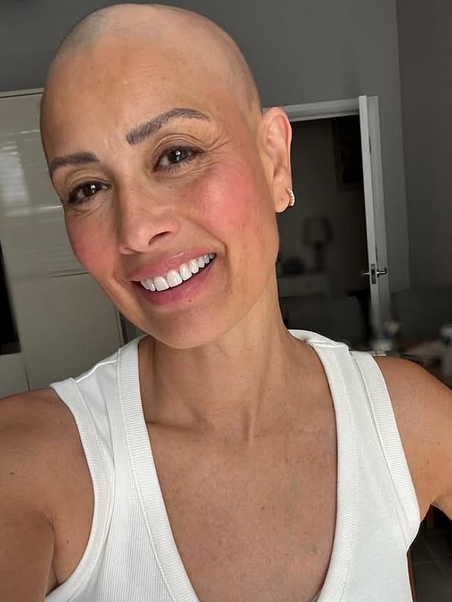 Medical experts warn that early alopecia signs include excess shedding and patchy loss.