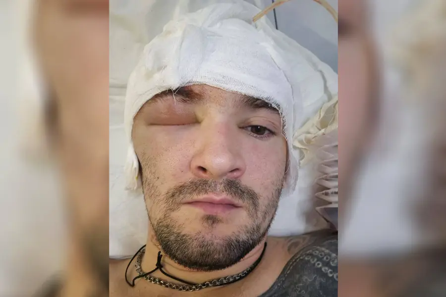 Russian Special Forces Operator Treated for Head Wound