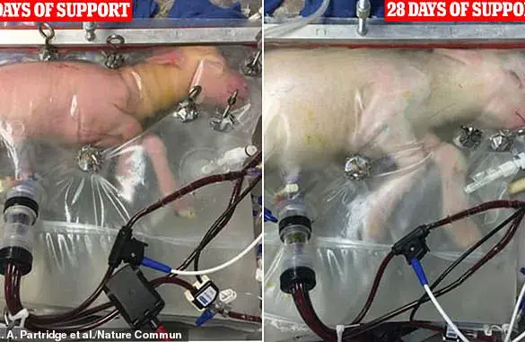 The Future of Pregnancy: Growing Babies in an Artificial Womb