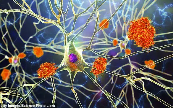 UCI Researchers Develop Breakthrough Stem Cell Therapy for Neurodegenerative Diseases