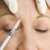 Botox: The Controversy of Transforming a Lethal Neurotoxin into a Popular Cosmetic Treatment