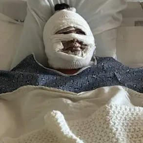 California Woman Suffering Severe Burns After Fire Pit Accident Sparks Safety Discussions
