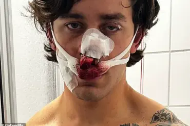 Exclusive: Inside the Secret World of the Dresden Assault as Told by the Injured Model and Paramedic