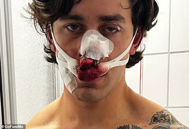 Exclusive: Inside the Secret World of the Dresden Assault as Told by the Injured Model and Paramedic